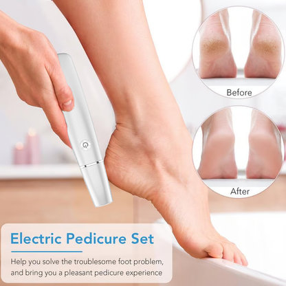 🌿Râpe électrique portable pour éliminer les callosités des pieds - Finadira®