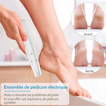 🌿Râpe électrique portable pour éliminer les callosités des pieds - Finadira®