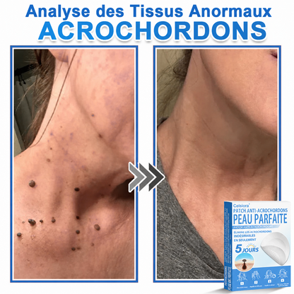 💚Pansements hydrocolloïdes à micro-aiguilles Celsiora® 2-en-1