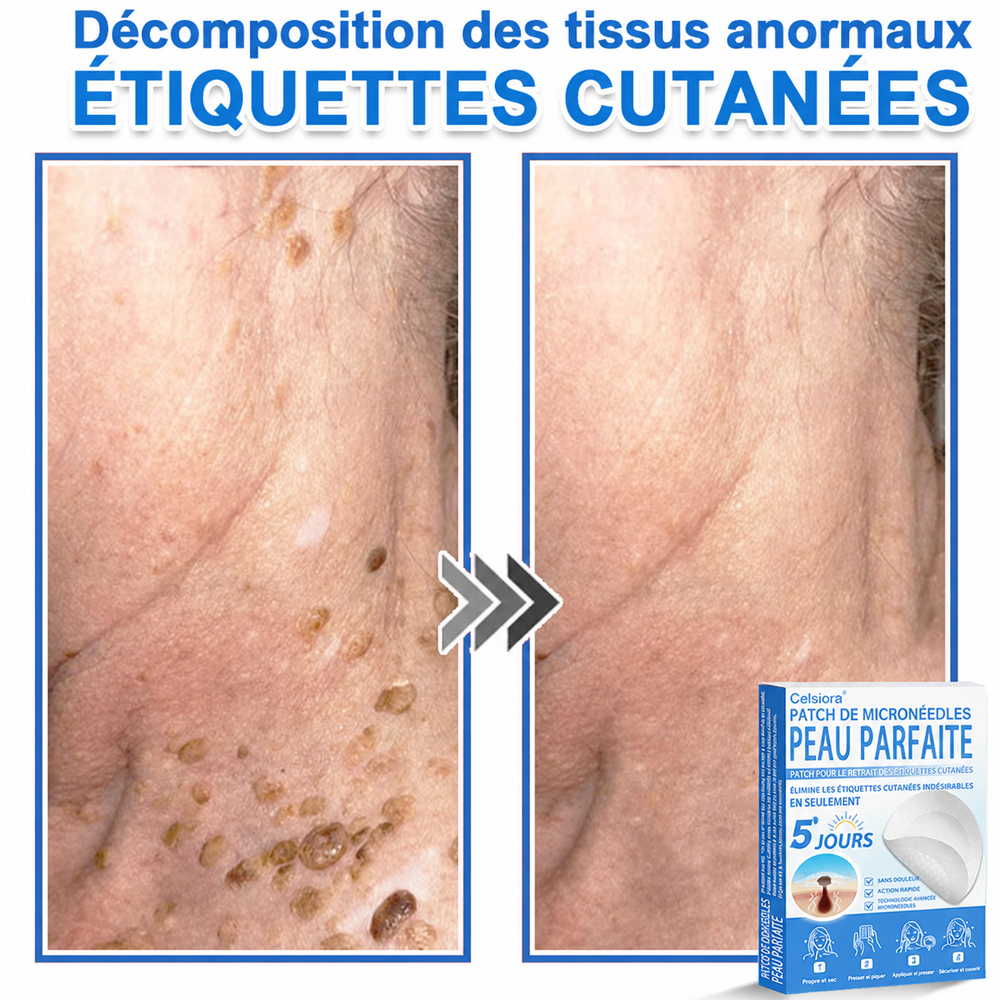 🟢Pansements hydrocolloïdes à micro-aiguilles Celsiora® 2-en-1