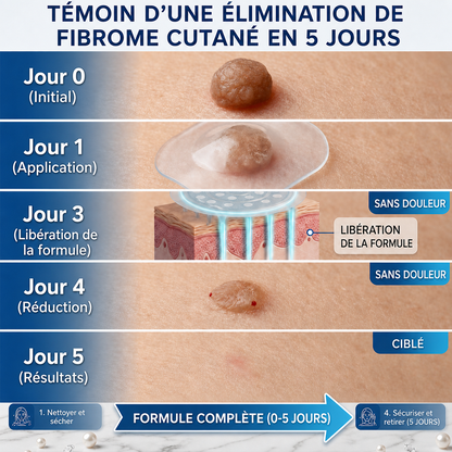 💚Pansements hydrocolloïdes à micro-aiguilles Celsiora® 2-en-1