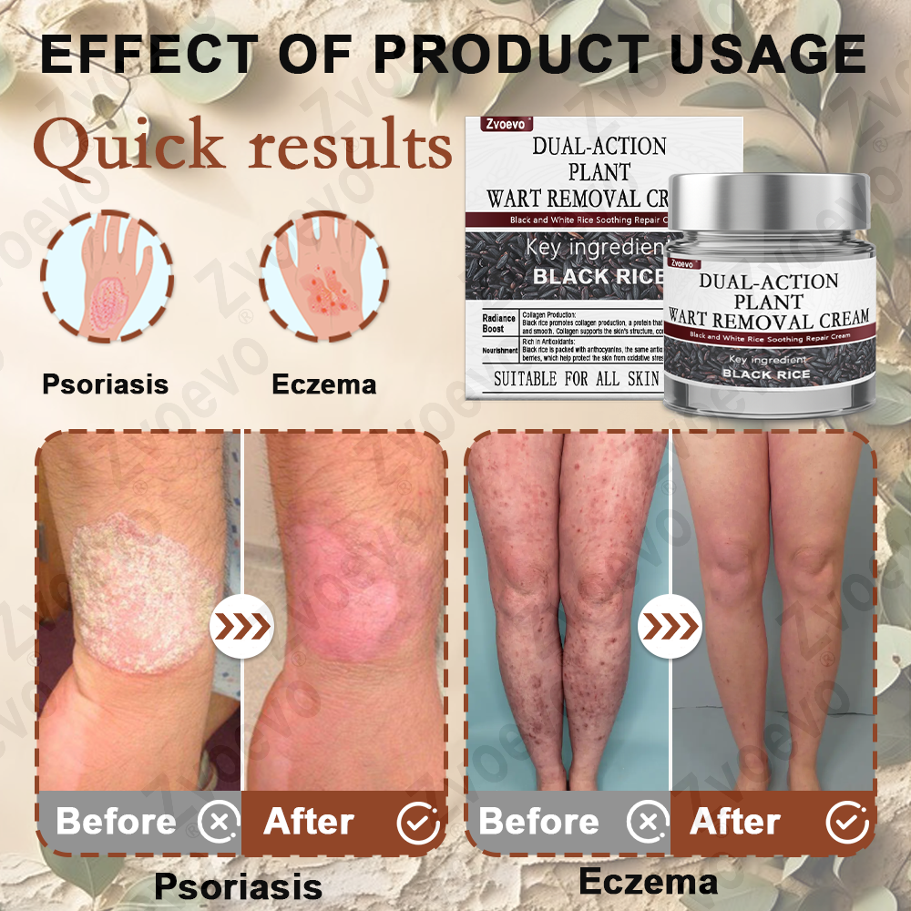 Celsiora®  Crème essence réparatrice au riz noir ⚕️ Certifiée TGA (Élimine les verrues et les excroissances cutanées, atténue l'accumulation de kératine et traite la dermatite séborrhéique, la kératose folliculaire et les taches de vieillesse)