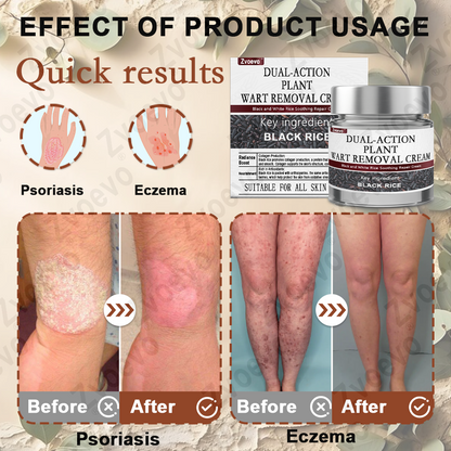 Celsiora®  Crème essence réparatrice au riz noir ⚕️ Certifiée TGA (Élimine les verrues et les excroissances cutanées, atténue l'accumulation de kératine et traite la dermatite séborrhéique, la kératose folliculaire et les taches de vieillesse)